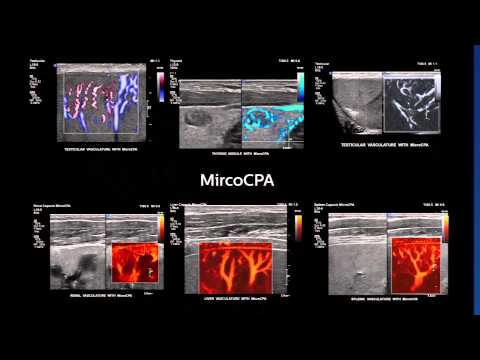 Ultrasound EPIQ new era in Ultrasound, Intelligence , Performance and Design